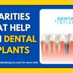 Charities That Help With Dental Implants